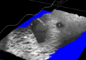 Real-Time Visual Terrain Reconstruction for BigDog, 2008